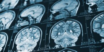 Así afecta la Inteligencia Artificial al cerebro humano: te sorprenderá