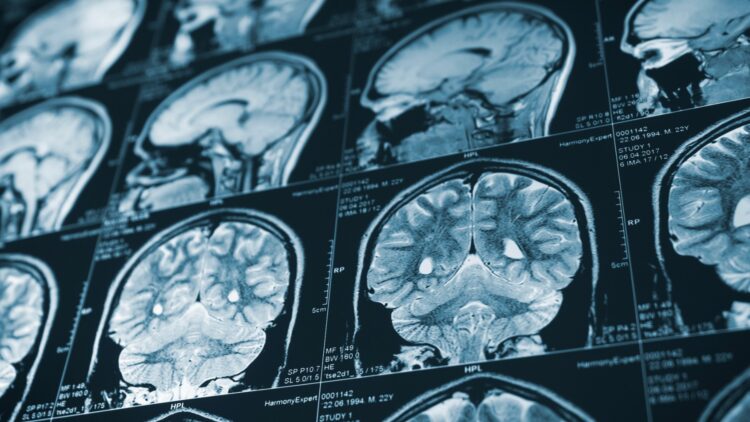 Así afecta la Inteligencia Artificial al cerebro humano: te sorprenderá