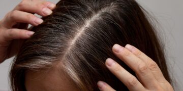 Estos métodos naturales revierten por completo el debilitamiento del cabello y favorecen un rápido crecimiento