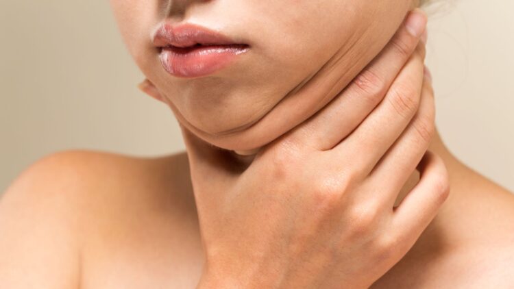 Dile adiós para siempre a la papada con este sencillo ejercicio 1 Dile adiós para siempre a la papada con este sencillo ejercicio