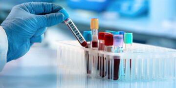 Científicos encuentran un nuevo tipo de sangre.