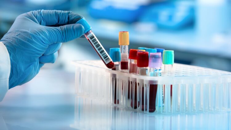 Científicos encuentran un nuevo tipo de sangre.