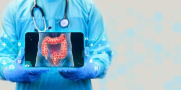 El principal desencadenante del cáncer de colon en los jóvenes es este