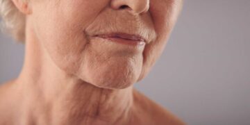 La razón por la cual la piel se arruga con el paso de los años