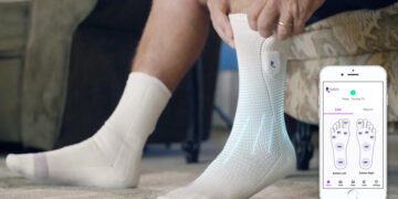 The discovery that is revolutionizing diabetes—MYNERVA's smart sock that restores lost sensitivity in the feet