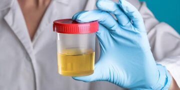 Goodbye to viewing urine as mere waste—scientists have managed to convert it into electricity using microbial fuel cells, and the result may change your idea of energy