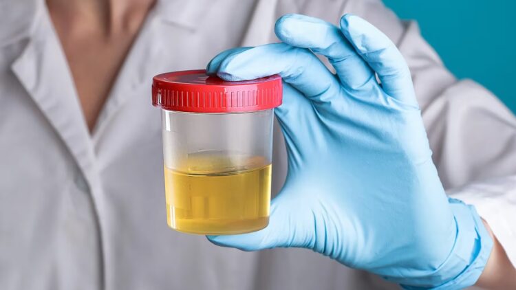 Goodbye to viewing urine as mere waste—scientists have managed to convert it into electricity using microbial fuel cells, and the result may change your idea of energy