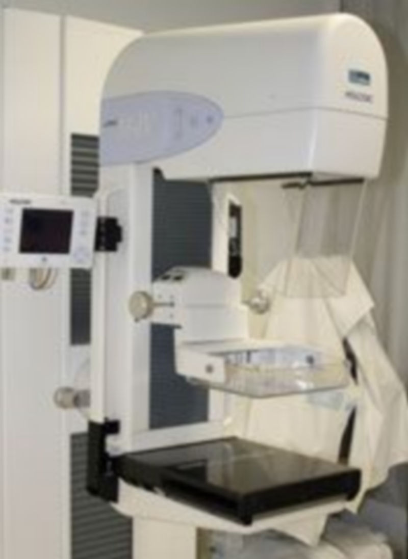 Imagen de un mamógrafo del Hospital General de Segovia. / El Adelantado