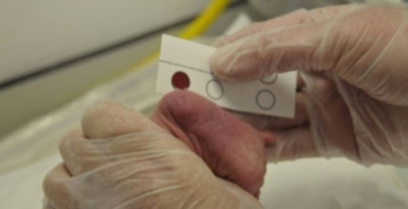 Imagen de archivo de una punción conocida como prueba del talón en niños con pocos días de vida. / Juan Martín