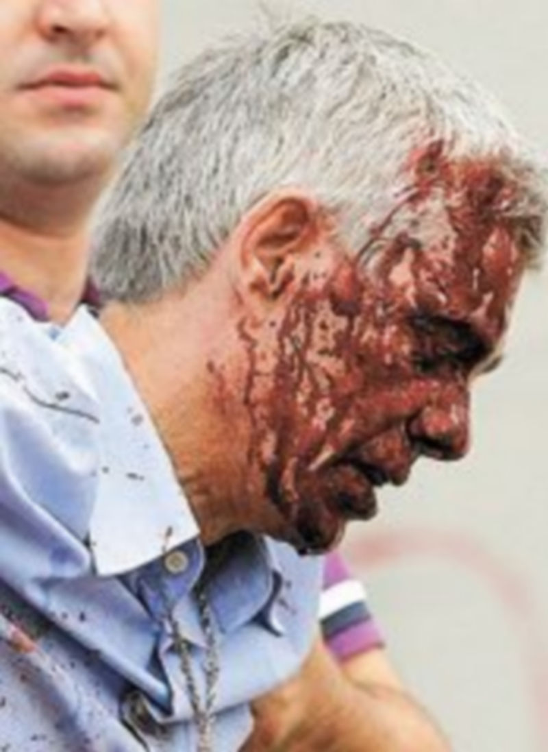 El chófer fue atendido tras el siniestro.