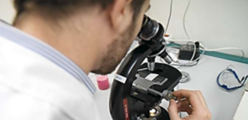 Un manual de enfermedades raras depurará datos de 167.000 casos 1 Un investigador analiza en un microscopio una muestra de un paciente para diagnosticar su enfermedad. / Europa Press