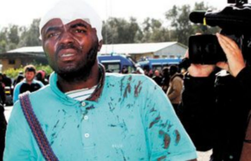 Las manchas de sangre en su ropa delatan la violencia de los ataques que han sufrido miles de jornaleros extranjeros en el sur de Italia. /REUTERS