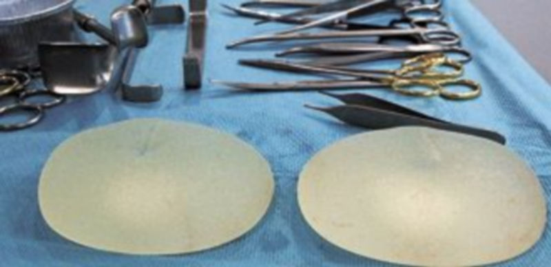 Los implantes mamarios PIP son prótesis de silicona de la empresa francesa Poly Implant Prothèse. / Reuters