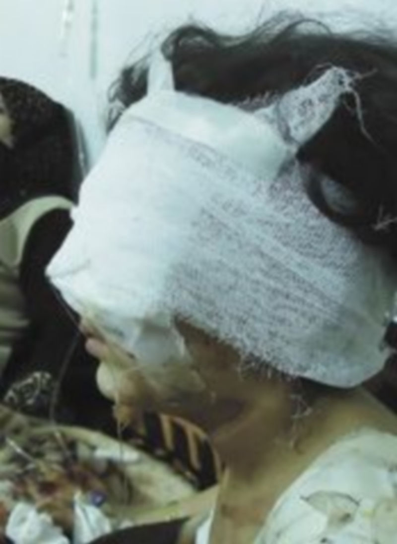 La ofensiva sobre Homs dejó varios centenares de heridos. / Reuters.