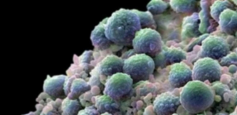 La idea es potenciar el bloqueo energético de los tumores con antimicóticos./ Efe