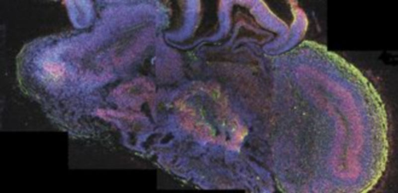 Imágenes del microcerebro