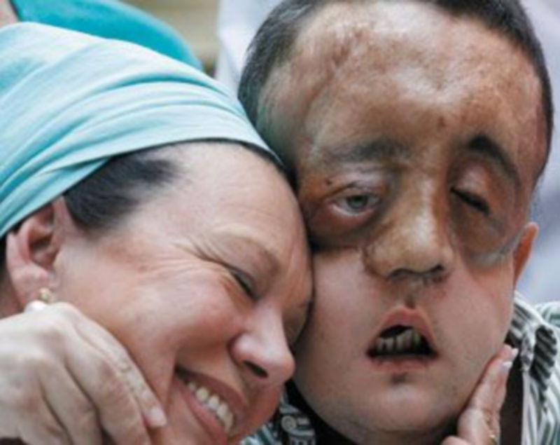 Rafael se abraza a una de las enfermeras del Virgen del Rocío de Sevilla antes de abandonar el hospital. / Efe