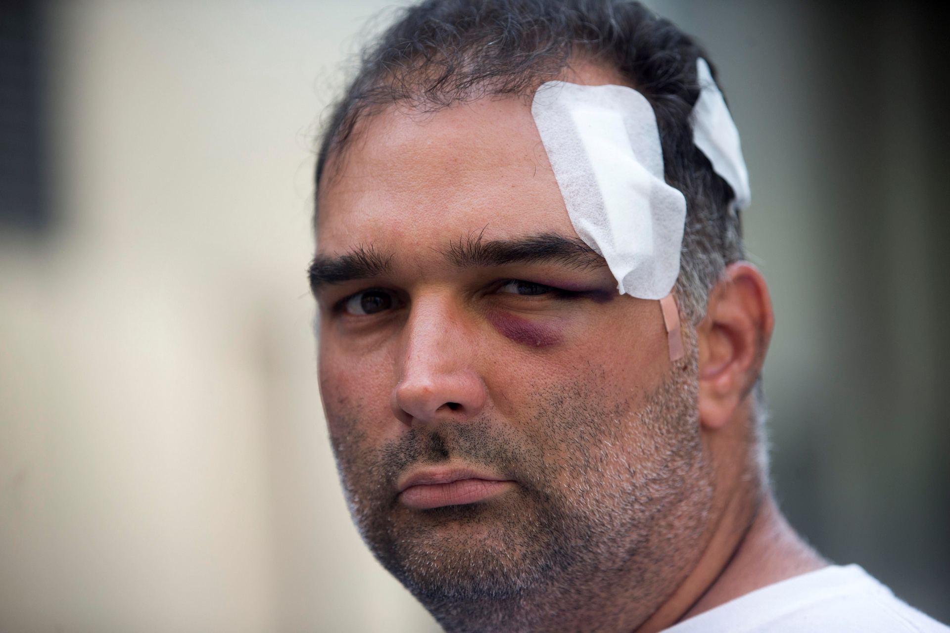 El turista estadounidense de origen cubano José Bravo, una de las víctimas de las agresiones de los manteros.