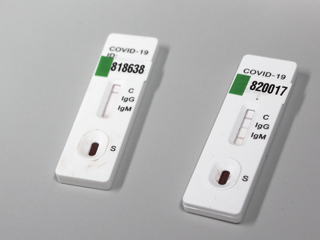 Kits para realizar la prueba de detección rápida. / E. A.