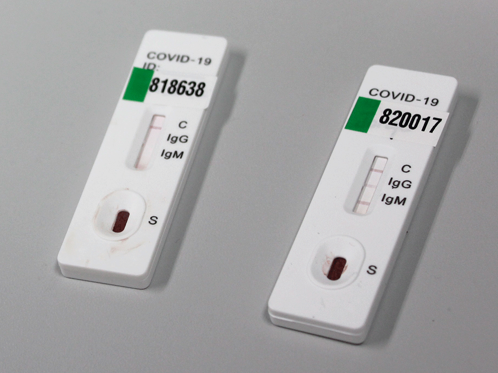 Varios kits de test rápidos de los que se utilizarán para hacer las pruebas a los docentes./ JUNTA CYL