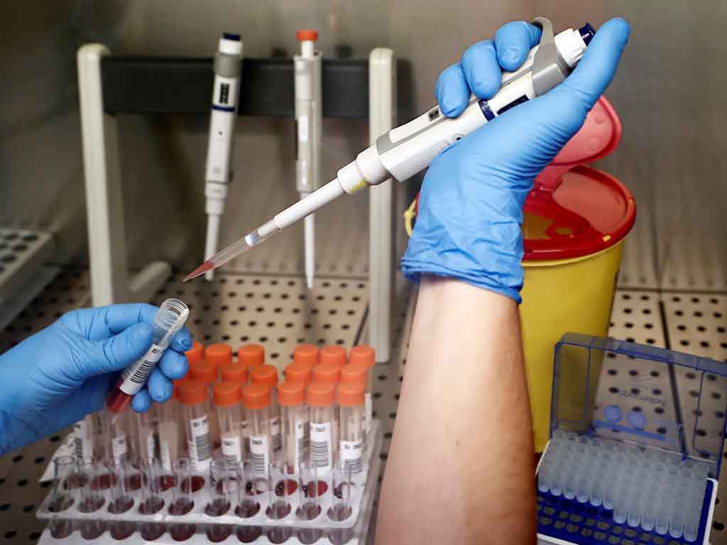 Análisis de la vacuna contra el Covid-19. EFE/ Jesús Diges/Archivo