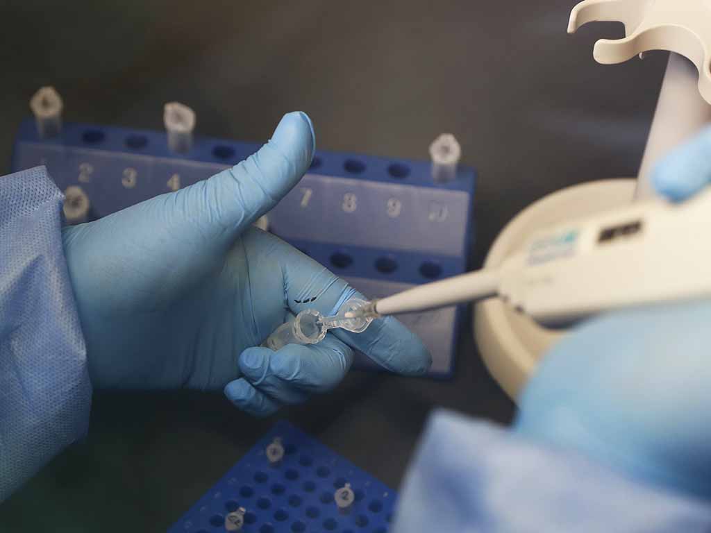 Se trata del primer ensayo fase III de este tipo autorizado en España. Se va estudiar la seguridad de esta vacuna que también se va a probar en otros ocho países y se reclutará hasta 30.000 voluntarios. EFE/PAOLO AGUILAR