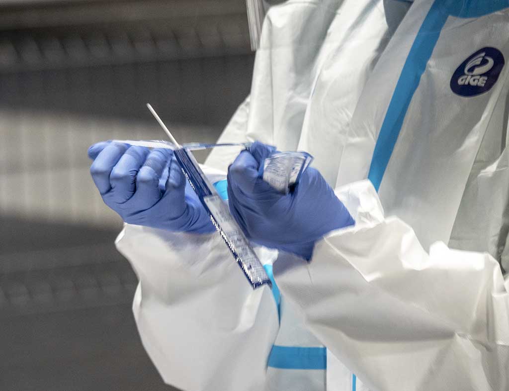 Cribado Conavirus PCR test antigenos