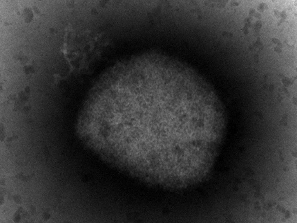 Imagen microscópica del virus causante de la viruela del mono, cuya secuenciación completa han logrado investigadores del Instituto de Salud Carlos III. Fotografía cedida por el Instituto de Salud Carlos III. / EFE