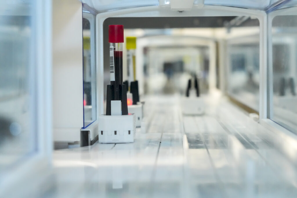 La nueva estructura automatizada de los laboratorios del Hospital General de Segovia transporta los tubos con las muestras de los análisis de un lugar a otro.